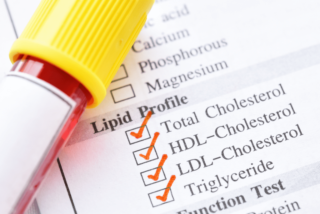 Cholesterol by the numbers: making sense of your lipid profile